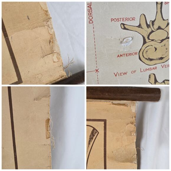Antique Anatomy Chart of Elementary Physiology Arnold 1908 Medical Poster UK - Picture 5 of 10